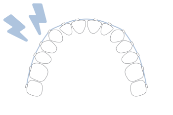 Invisalign Frankfurt