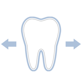 Invisalign Frankfurt