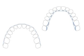 Invisalign Frankfurt