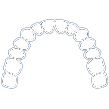 Invisalign Vorteile & Nachteile