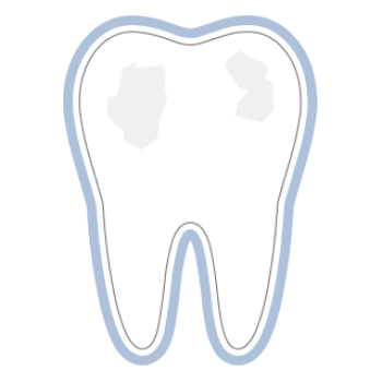 Invisalign Frankfurt