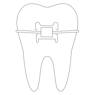 Invisalign