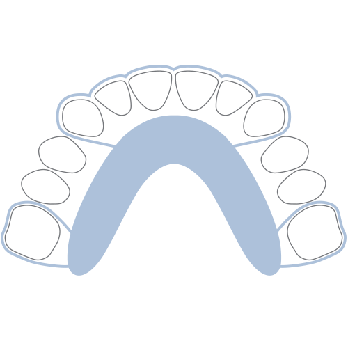 Invisalign