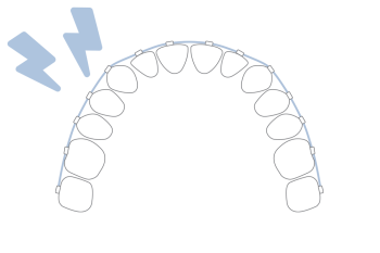 Invisalign Frankfurt
