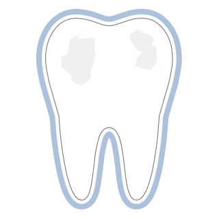Invisalign Frankfurt
